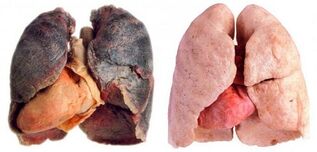 poumons du fumeur et en bonne santé